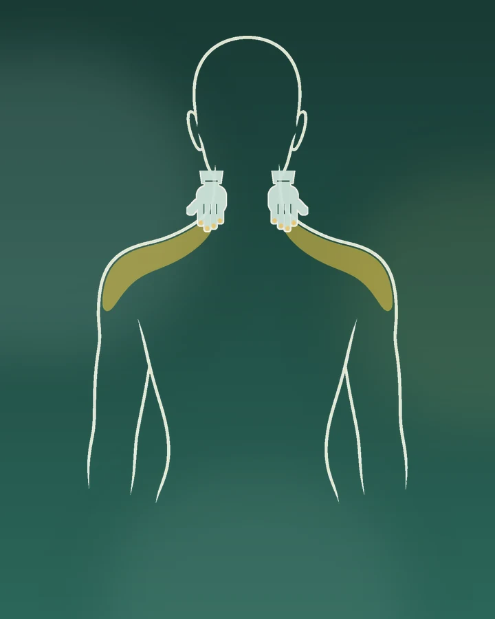 Maraze shoulder placement guide
